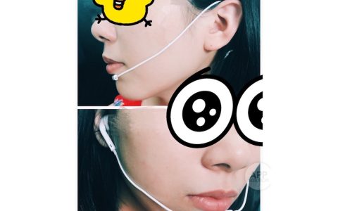 打电话时怎样去除环境杂音 耳机特殊用法
